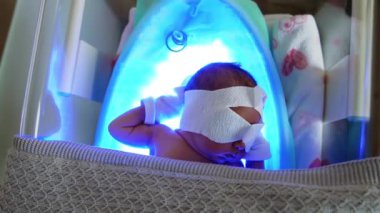 Üç günlük yeni doğmuş bebek göz örtüsü ve eldivenler tıbbi inkübatörde yatıyor. Sarılığı olan bir çocuk için fototerapi prosedürü. Üst görünüm.