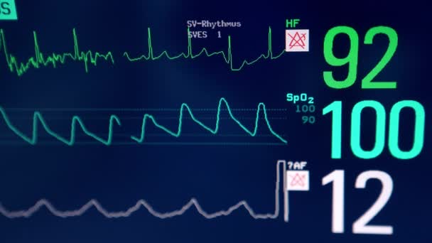 Parametry Życiowe Pacjenta Czarnym Ekranie Urządzenia Monitor Bliska Wentylatora Płuc — Wideo stockowe