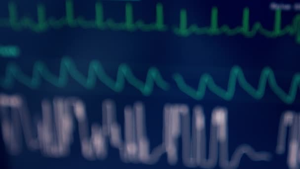 Linhas Curvas Correr Monitor Escuro Ventilador Pulmonar Exibição Sinais Vitais — Vídeo de Stock