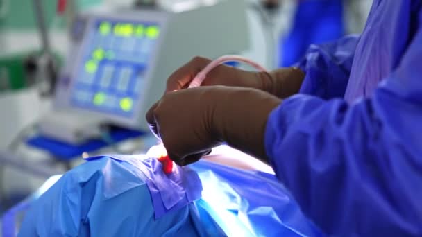 Руки Хирурга Стерильных Перчатках Суют Инструменты Нос Пациенту Помощник Передаёт — стоковое видео
