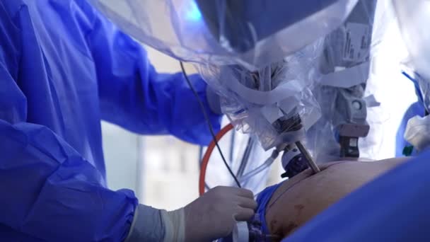 Abdomen Paciente Con Brazo Robótico Entrada Moviéndose Dentro Doctor Uniforme — Vídeos de Stock