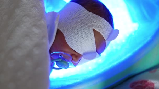 Маленька Дитина Спеціальній Оболонці Очей Лежить Ультрафіолетовій Лампі Дитина Пацифістом — стокове відео