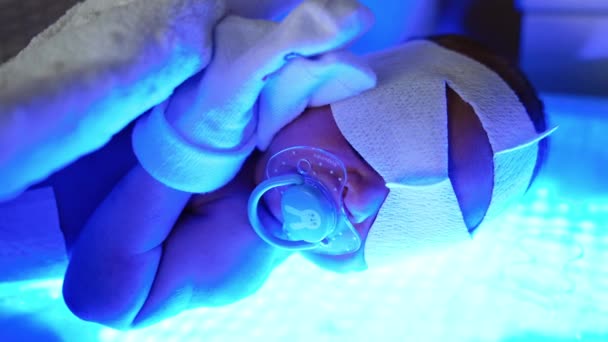Ljusbehandling För Ett Nyfött Barn Behandling Barngulsot Förlossningssjukhus Närbild — Stockvideo