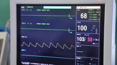 Ameliyat edilen hastanın yaşam belirtilerini gösteren bir ekran. Ameliyat sırasında çalışan modern ekipmanlar. Kapat..