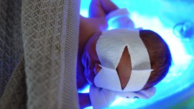 Gözleri bandajlı yeni doğmuş bebek elleri ultraviyole lambanın arkasında yatıyor. Battaniyeyle kaplanmış küçük çocuk yüksek dozda bilirubin ile tedavi ediliyor. Üst görünüm kapat.