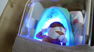 Bebek battaniyenin altında bir beşikte ve ultraviyole lambanın üzerinde yatıyor. Yenidoğan, fotoğraf terapisiyle sarılık tedavisi görüyor. Üst görünüm.