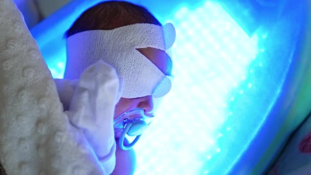 目に包帯が付いている小さい子供は紫外線ランプで眠ります ハイパーアロビノミア 産科病院での治療 クローズアップ — ストック動画