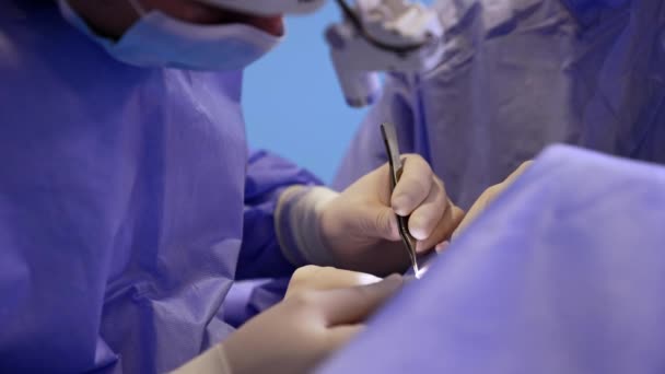 Operation Thyroid Modern Clinics Surgeon Carefully Uses Forceps Scalpel Lighting — Stock Video