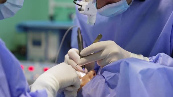 Blepharoplastika Provedena Použitím Moderních Zařízení Nástrojů Neznámý Chirurg Reflektorem Provádí — Stock video