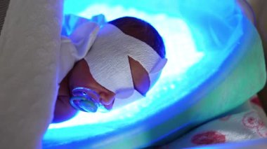 Yeni doğan aktif emzik emziği ultraviyole lambanın beşiğinde yatıyor. Küçük bebek neonatal sarılık tedavisi görüyor. Üst görünüm.