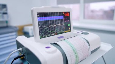 Hastanenin koğuşunda kardiyograf çalışıyor. Doğum kliniğinde kalp muayenesi için gelişmiş ekipman. Kapat..