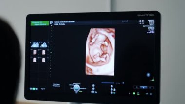 Doğmamış bebek görüntüsü olan siyah monitör. Hamilelik teşhisi için ultrason cihazları.