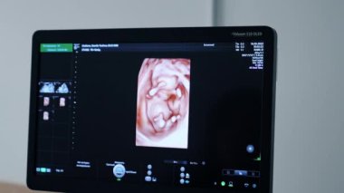 Anne karnındaki bir bebeğin 3 boyutlu görüntüsü. Hamile kadının muayenesi sırasında ultrasonik ekipman ekranı. Kapat..
