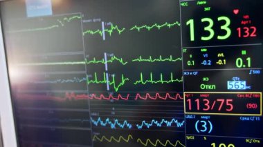 Kalp atışı, nabız ve oksijen seviyesi akciğer solunum cihazının monitörüne yansıyor. Kapatın. Ameliyathanede çalışan ekipman..