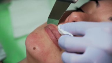 Güzellik uzmanının eldivenli elleri ultrasonik temizleyiciyi beyaz kadın yüzünden hareket ettiriyor. Cilt bakımı konsepti. Çok yakın çekim..