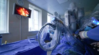 Eldivenli bir doktorun, robot kolla birlikte hareket eden bir aleti tutuşu. Duvardaki ekran prosedürü gösteriyor. Da Vinci robotu hastayı ameliyat ediyor..