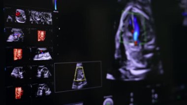 Ultrason makinesinde henüz doğmamış bir çocuk var. Modern ekipmanlar üzerinde bebek gelişimi incelemesi.