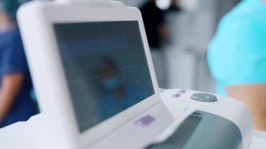 Elektrokardiyografın bulanık ekranını kapat. Bebeğin kalp atış hızı için ekipman. Doğum odasına bakın..