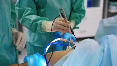 Ellerinde laparoskopik aletler tutan lateks eldivenli iki cerrahın elleri. Modern hastanede laparoskopi yapılıyor..