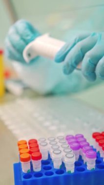 Laboratuvarda kan örneği toplamak için vakum tüpleri. Araştırma laboratuarında elinde kan tüpü testi tutan teknisyen.