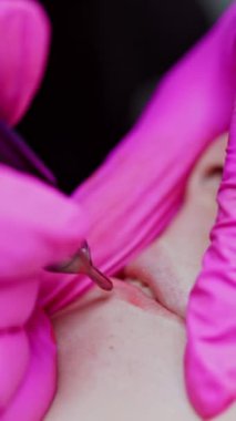 Mikroplama prosedürü. Genç kız dudaklarına kalıcı makyaj dövmesi yapıyorum. Elleri koruyucu eldivenlerle dudaklarında dövme yapan bir kozmetik uzmanı. Yakın plan. Dikey video