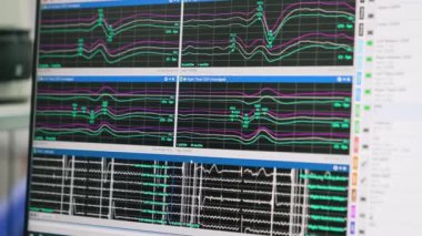Çalışan eğri çizgileri olan monitör. Kapatın. Nörofizyolojik sorunların tedavisinde nöroizleme.