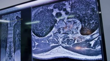 İnsan organları ve sistemleri MRI taramasında. Kapatın. Tanımlanamayan doktor beyin cerrahisinden önce taramayı analiz ediyor..