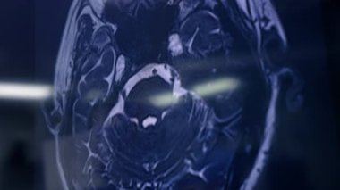 Kafa MR 'ı çekiliyor. Röntgen görüntüsü olan büyük ekran. Kapatın. Ameliyathane ekipmanı.