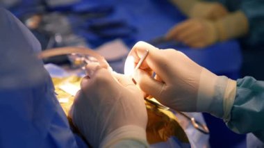 Beyin cerrahının eldivendeki elleri uzun ince metal alet kullanır. Doktor elektrikli cihazın enstrümanını değiştirir. Kapat..