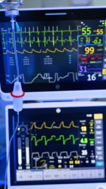 Bulanık yaşam çizgileri olan akciğer havalandırma makinesinin monitörleri. Teslimat tezgahı ön planda asılı duruyor. Dikey video.