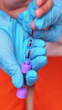 Doktor, hastanın kanını test ediyor. El doktorunun hastalarının kanını hastanede test etmesini yakından izleyin. Dikey video