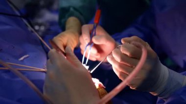 Ameliyat yapan lateks eldivenli doktorlar. Kapatın. Modern hastanede beyin cerrahisi.