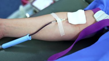 Damardan donörün damarına serum yerleştiriliyor. Kapatın. Hastanede kan bağışı konsepti.