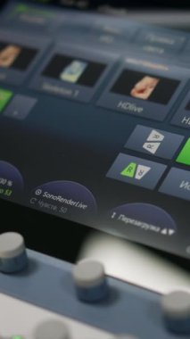 Sonografi cihazındaki sensör ekranı ve klavye. Kapatın. Hastanedeki modern ultrason testleri için ekipman.