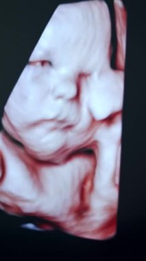 Doğmamış bebeğin, onun elini tutarken ki görüntüsü çok şirin. Ultrasonik makine monitöründeki çocuğun rahim içi fotoğrafı..