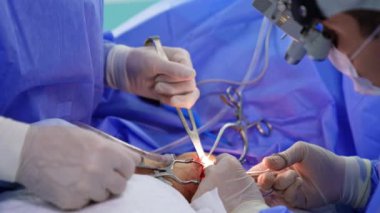 Cerrahi asistanı, cerrahın kesiğe ulaşmasını kolaylaştırmak için tıbbi bir alet tutuyor. Cerrahi lenslerdeki doktor forseps takıyor. Kapat..