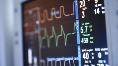 Ameliyattaki bir hastanın numaraları ve parametreleri. Akciğer ventilatörü, ameliyat altındaki bir insanın yaşam sinyallerini gösteriyor. Kapat..