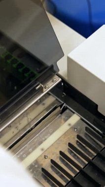 Laboratuvar uzmanının eldivenli eli test tüpleriyle tezgahı ekipmana yerleştiriyor. Modern hastanede kan tahlili için kullanılan makine. Dikey video