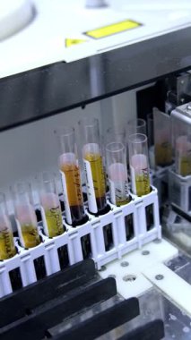 Üzerinde el yazısıyla işaretler olan test gözlükleri makinedeki özel tutacağa yerleştirilmiş. Laboratuvarda gelişmiş ekipmanlarla yapılan kan testi sonuçları. Dikey video