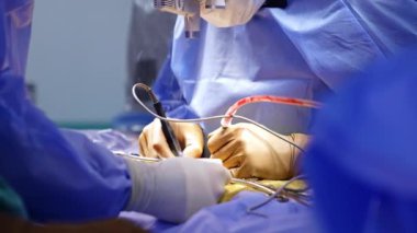 Plastik eldivenli tanınmamış bir cerrahın elleri operasyonda elektrikli alet kullanıyor. Doktorun elindeki cihaz duman çıkarıyor. Nöroşirürji devam ediyor..