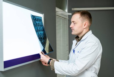 Doktor bir muayenehanede röntgen görüntülerini inceliyor. Bir tıp uzmanı, modern bir klinik ortamında hasta bakımı ve sağlık değerlendirmesine odaklanmış teşhis için röntgen görüntülerini inceler..