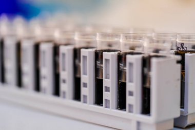 Laboratuvar kasetleri ve araştırma için örnekler. Çeşitli laboratuvar kasetlerinde çalışma sırasında analiz için hazırlanmış örnekler bulunur..