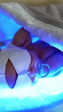 Bebek bezi ve eldiven takmış güzel, çıplak bir bebek beşikte yatıyor. Bebek fototerapi ile neonatal sarılıktan kurtulur. Dikey video