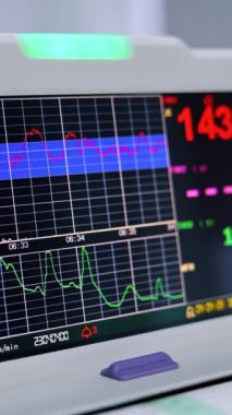 Hastane koğuşunda çalışan CTG cihazı ekranı. Kapatın. Tıbbi teşhis ekipmanları. Dikey video