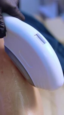 Kozmetik uzmanının eldivenli eli lazeri bacağa doğru hareket ettiriyor. Güzellik salonunda saç çıkarma prosedürü. Kapatın. Dikey video