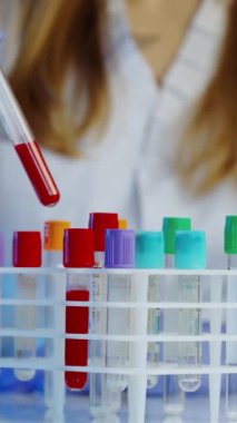 Kan örneği tüpleri. Doktor el, laboratuvarda analiz makineleri olan bir raftan kan örneği alıyor.