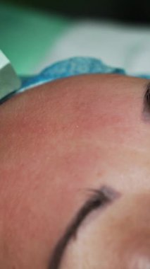 Güzellik uzmanı özel bir aletle ultrasonik yüz temizleme yapıyor. Cilt bakımı. Aşırı yakın çekim. Dikey video