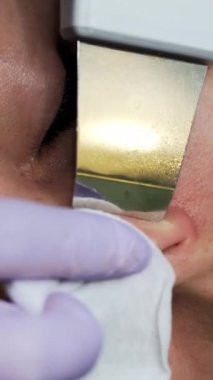 Deri kusurlarını ultrasonik fırçayla temizliyor. Güzellik uzmanı kozmetik aletini kadın burun deliklerinde gezdiriyor. Aşırı yakın çekim. Dikey video