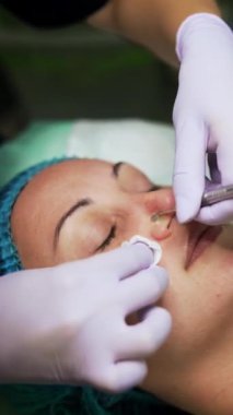 Güzellik salonunda porno temizliği. Beyaz kadın, kozmetik aletinin yardımıyla siyah başlıkları çıkarma prosedürünü uyguluyor. Üst Manzara. Dikey video