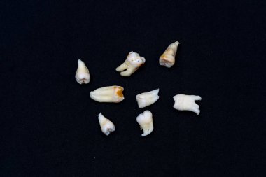 Siyah yüzeyde diş örnekleri. Çeşitli insan dişleri siyah bir arkaplanda sıralanır, çeşitli bireylerden farklı şekiller ve boyutlarda sergilenir..